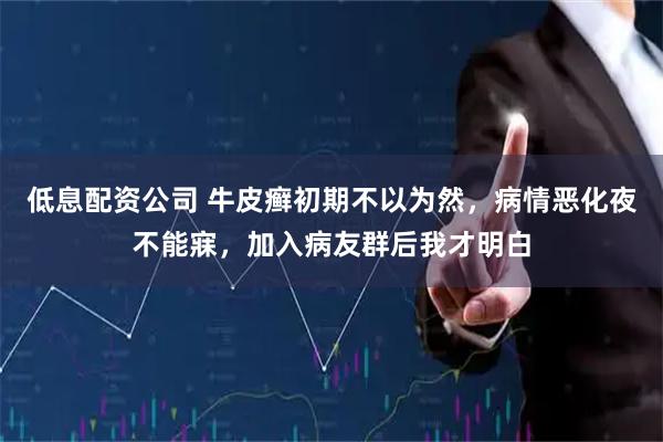 低息配资公司 牛皮癣初期不以为然,病情恶化夜不能寐,加入病友群后我才明白
